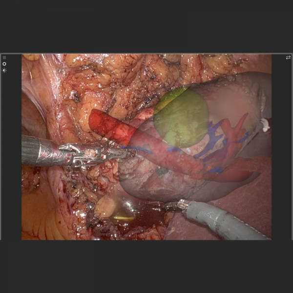 Vision and Endoscopy - Image 6