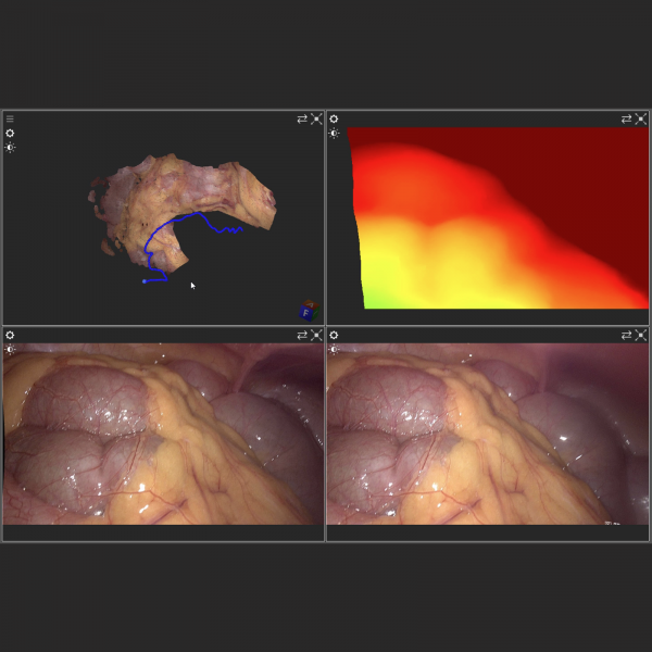 Vision and Endoscopy - Image 4