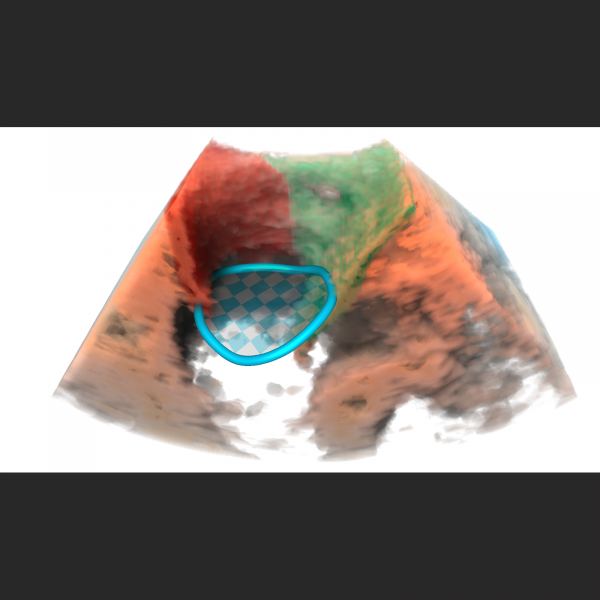 Ultrasound - Image 2