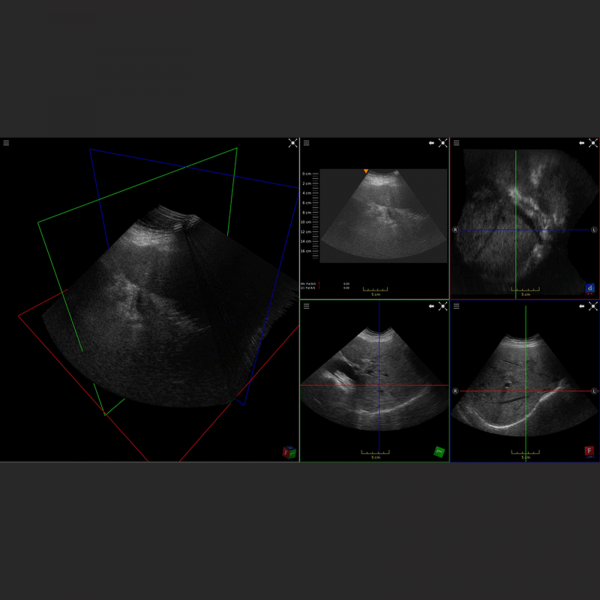 Ultrasound - Image 5