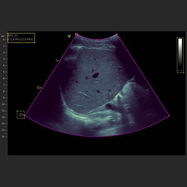 Ultrasound - Image 4