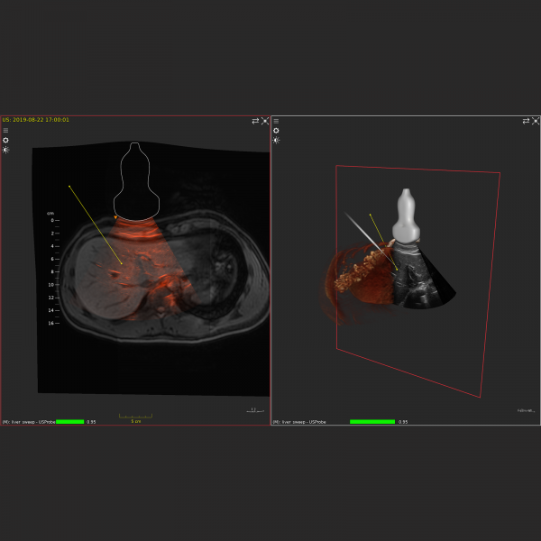 Ultrasound - Image 3