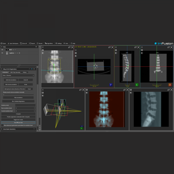 X-Ray and CT - Image 3