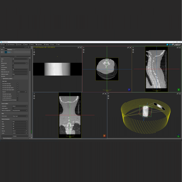 X-Ray and CT - Image 2